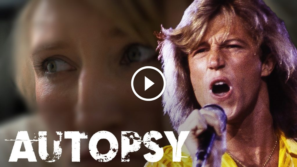 Andy Gibb: The Truth Behind His Death at 30 Andy Gibb: The Truth Behind His Death at 30
