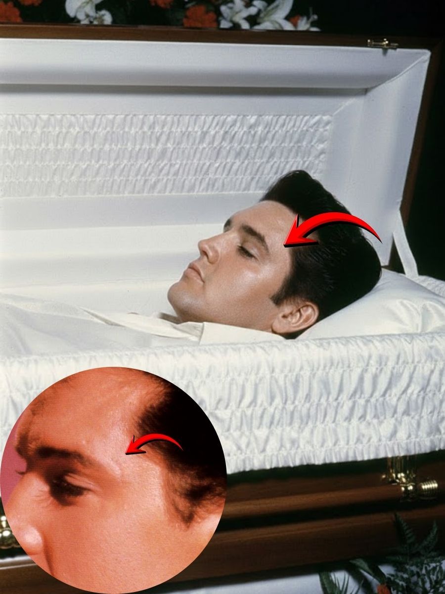 “THE SCAR THAT VANISHED: One Detail Inside Elvis Presley’s Coffin That Still Haunts the World”