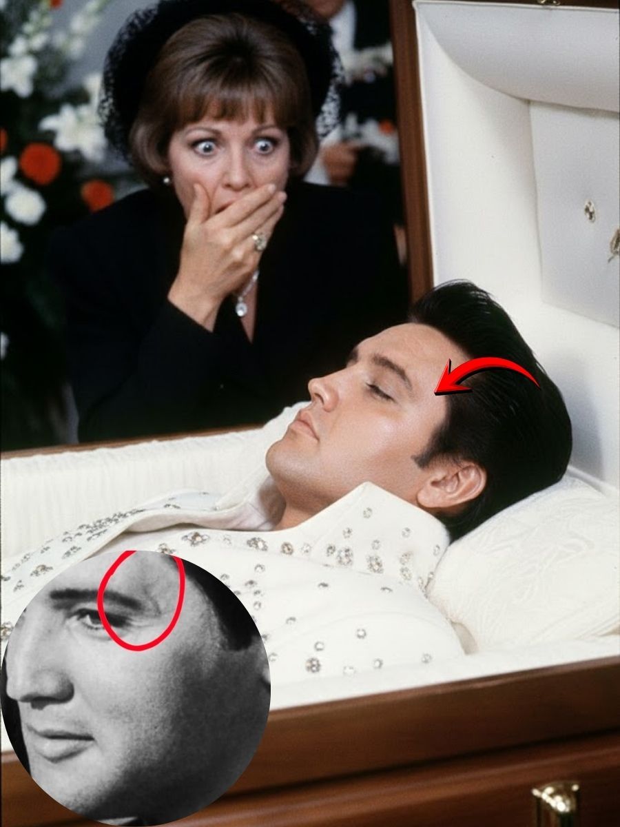 “THE SCAR THAT SHOULDN’T HAVE DISAPPEARED — The Elvis Presley Coffin Detail That Still Terrifies Witnesses”