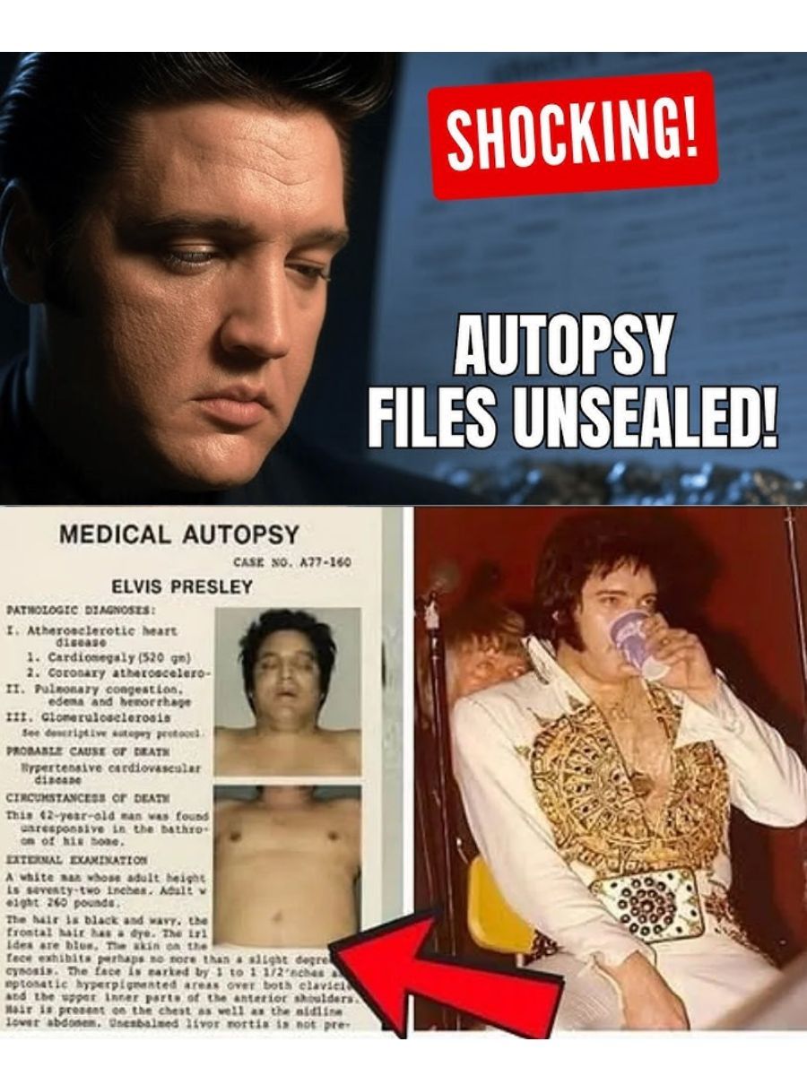 “THEY SAID ‘HEART FAILURE’ — But the Autopsy Whispers Reveal How Elvis Was Slowly Breaking”